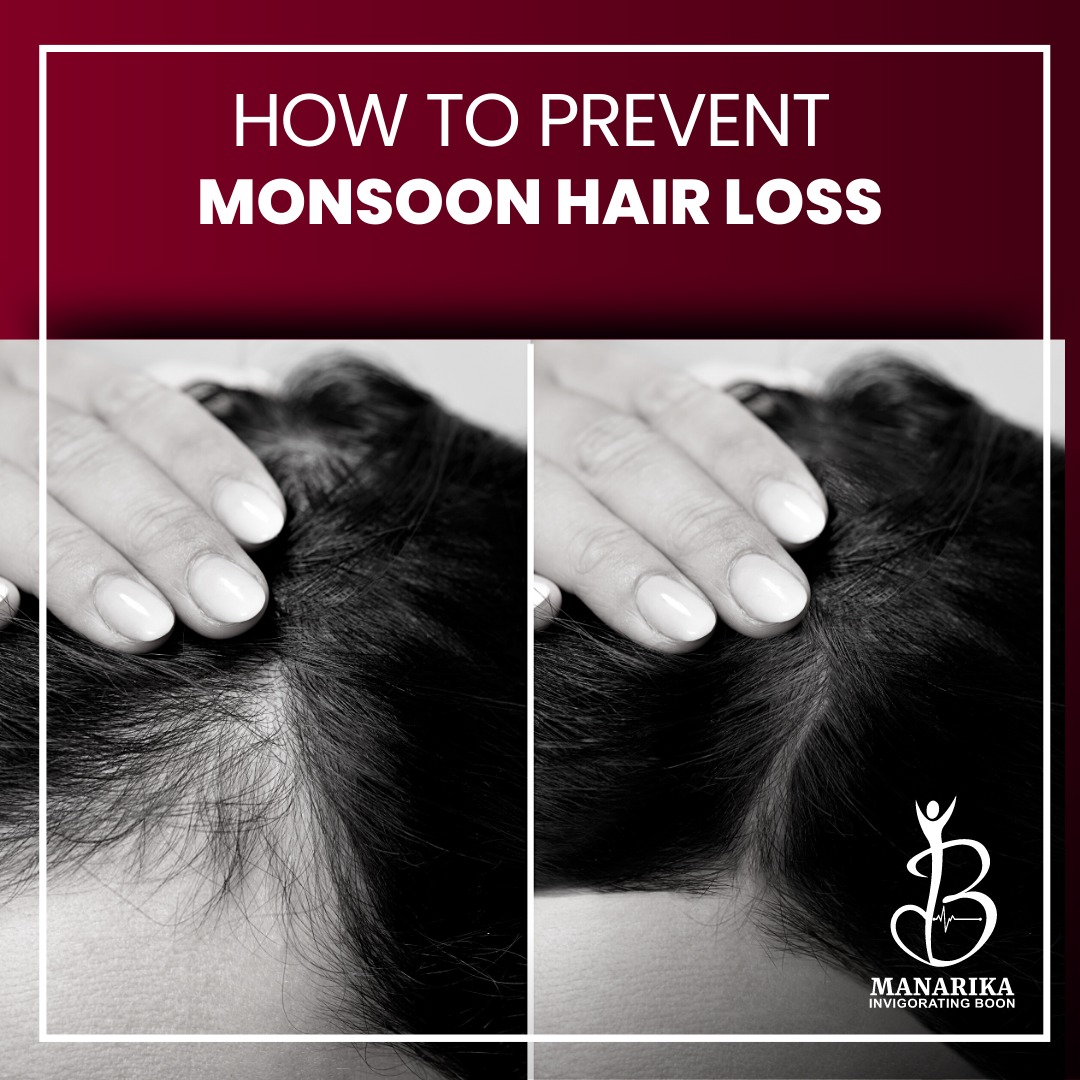 EFFECTIVE TIPS TO PREVENT HAIR FALL DURING MONSOON